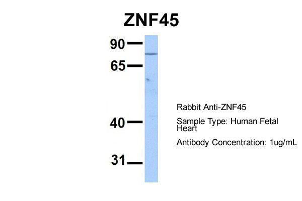 1 - ZNF45 antibody - N-terminal region AI10865