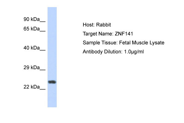 1 - ZNF141 Antibody - N-terminal region AI10869