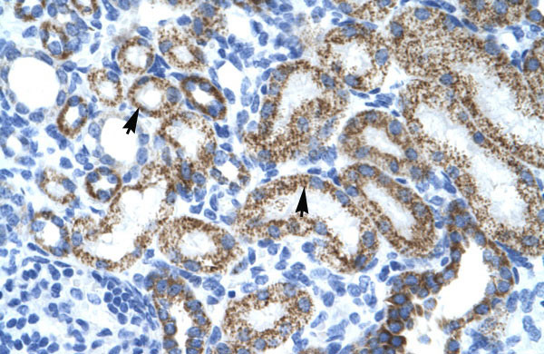 2 - MYCL1 antibody - middle region AI10877