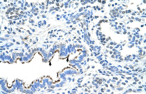2 - ZNF239 antibody - middle region AI10879