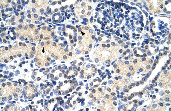 2 - ZNF271 antibody - N-terminal region AI10886