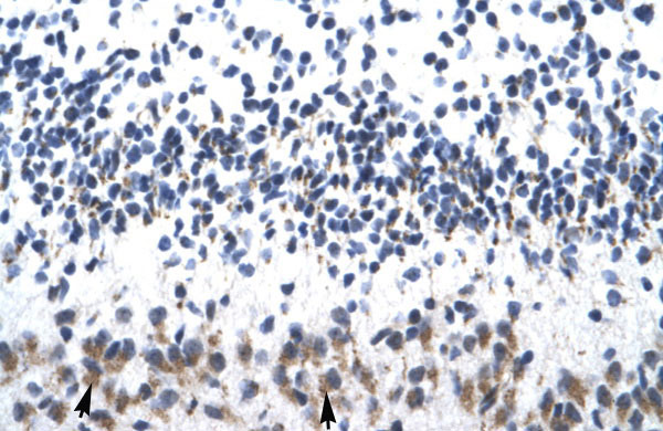 2 - ZNF266 antibody - N-terminal region AI10889