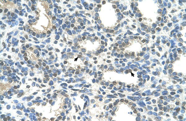 2 - HOXC9 antibody - middle region AI10890