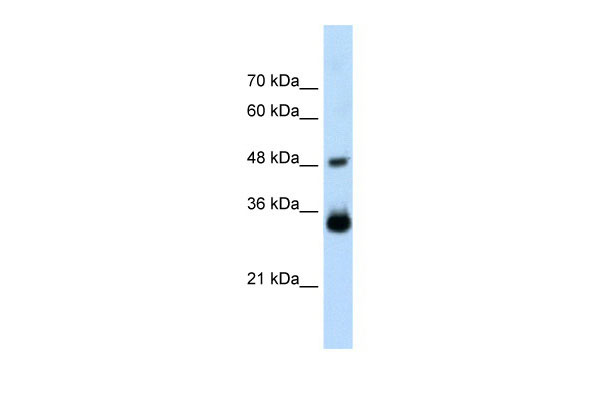 1 - HOXC9 antibody - middle region AI10890