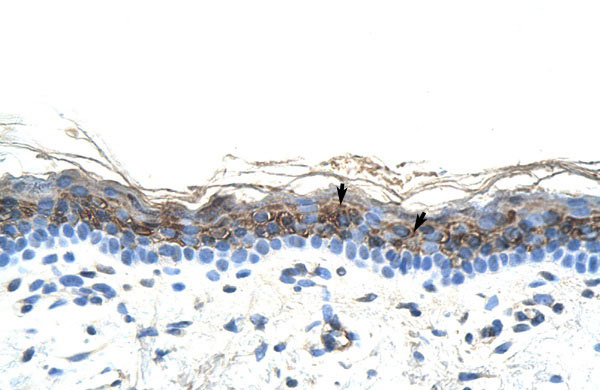 2 - ZIC2 antibody - C-terminal region AI10893