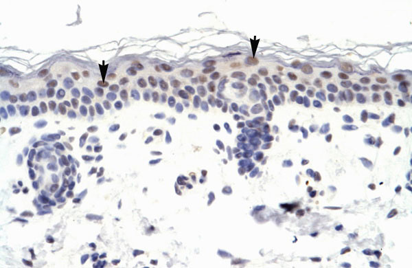 2 - ZNF223 antibody - N-terminal region AI10902