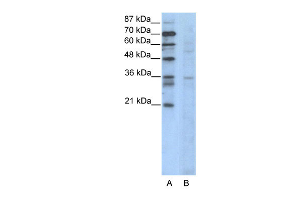 1 - CCNB3 antibody - N-terminal region AI10932