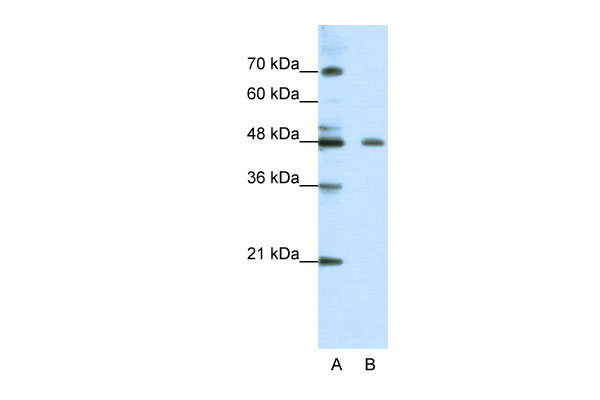 1 - ZNF645 antibody - N-terminal region AI10949