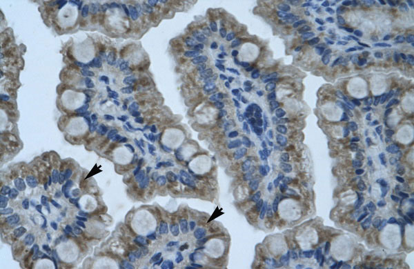 2 - GIOT-1 antibody - N-terminal region AI10954