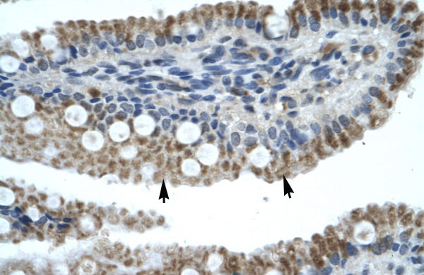 2 - ZNF683 antibody - N-terminal region AI10957
