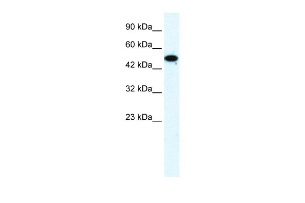 1 - FLJ31875 antibody - middle region AI10963