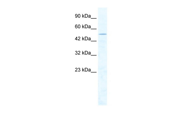 1 - CHD1L antibody - middle region AI10970