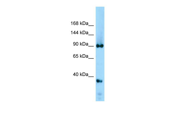 1 - Ddx20 Antibody - middle region AI10975