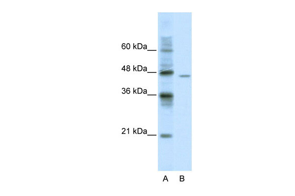 1 - DDX25 antibody - C-terminal region AI10978