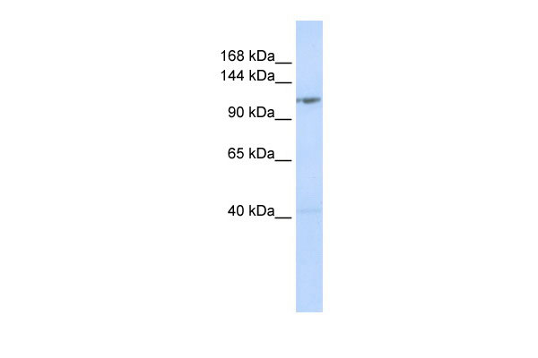 1 - DDX46 antibody - middle region AI10983