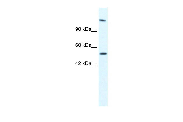 1 - HELB antibody - N-terminal region AI10992