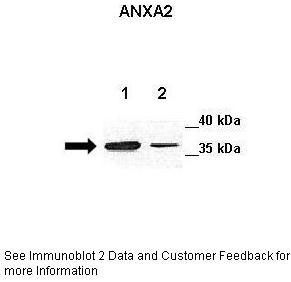1 - ANXA2 antibody - C-terminal region AI11001