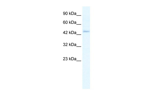 1 - ZBP1 antibody - middle region AI11021