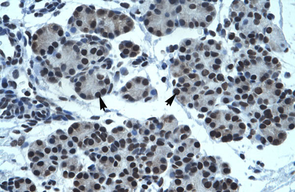 2 - TPTE antibody - C-terminal region AI11022