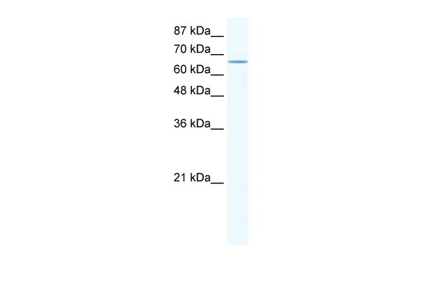 1 - CACNB2 antibody - N-terminal region AI11023