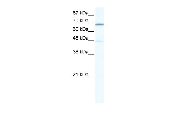 1 - CACNB2 antibody - C-terminal region AI11024