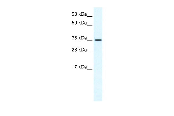 1 - TRPM3 antibody - N-terminal region AI11026