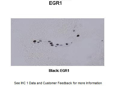 2 - Egr1 antibody - C-terminal region AI11043