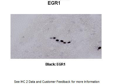 2 - Egr1 antibody - C-terminal region AI11043