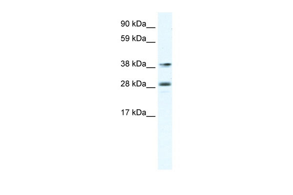 1 - MEF2B antibody - C-terminal region AI11066