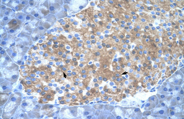 2 - Pias2 antibody - C-terminal region AI11070