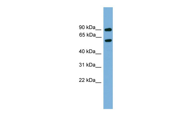 1 - Nab2 antibody - middle region AI11072