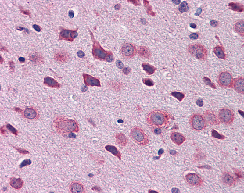 2 - Tbr1 antibody - N-terminal region AI11085