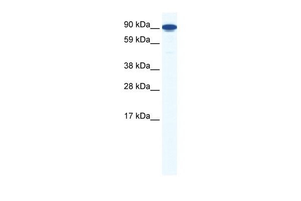 1 - ZFY1 antibody - middle region AI11095