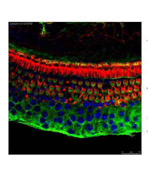3 - Atf4 Antibody AI11101