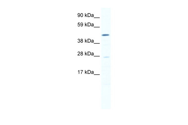 1 - SMYD1 antibody - N-terminal region AI11103