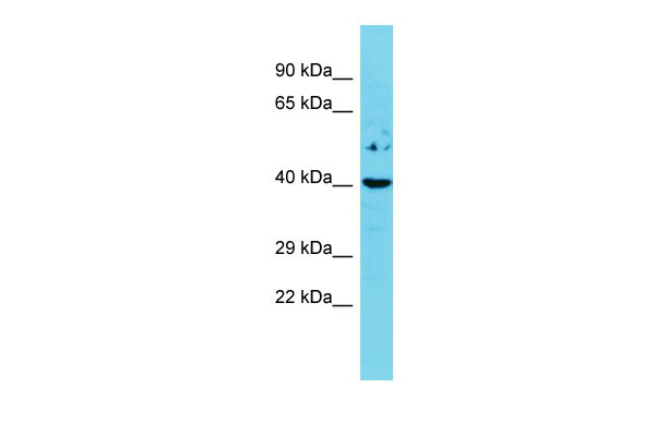 1 - Esr2 Antibody - N-terminal region AI11108