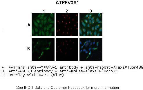 2 - Atp6v0a1 antibody - C-terminal region AI11157