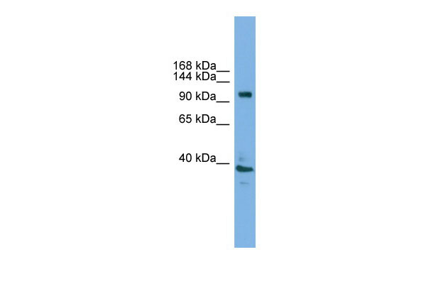 1 - Atp6v0a1 antibody - C-terminal region AI11157