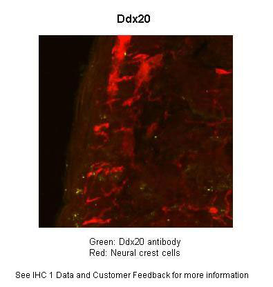 2 - Ddx20 antibody - N-terminal region AI11159