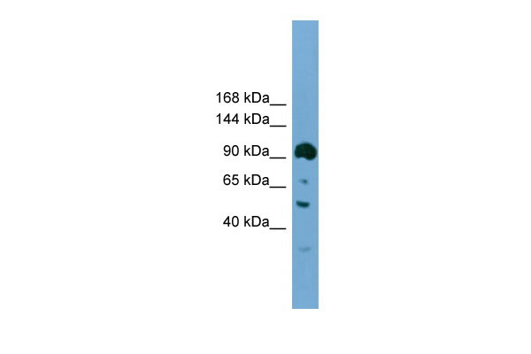 1 - Ddx20 antibody - N-terminal region AI11159