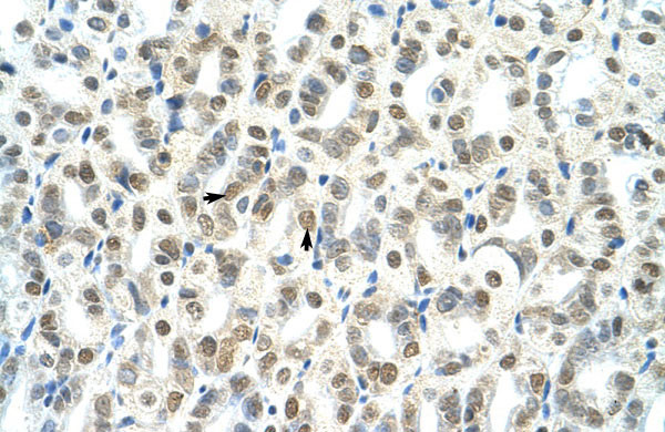 2 - Tsc22d4 antibody - N-terminal region AI11186