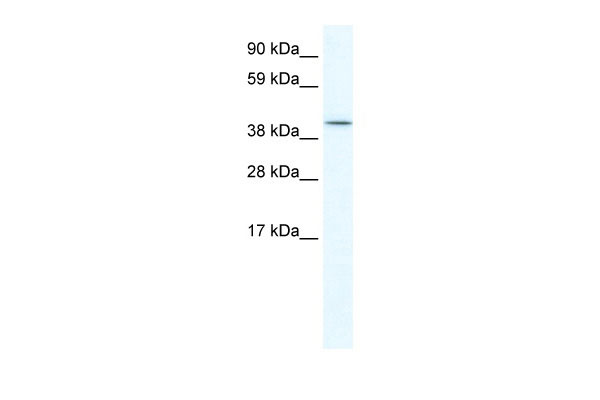 1 - ISL2 antibody - C-terminal region AI11198
