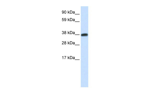 1 - DMRTC2 antibody - N-terminal region AI11202
