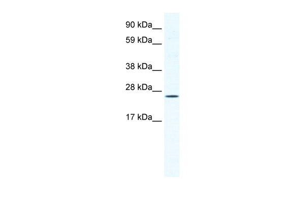 1 - BRF1 antibody - C-terminal region AI11204