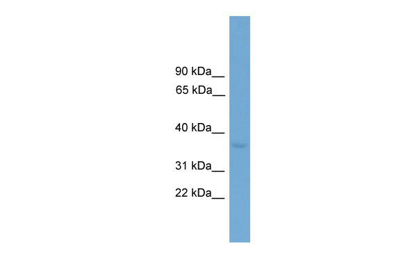 1 - Zfp444 antibody - C-terminal region AI11205