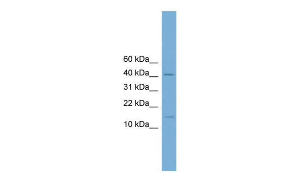 1 - Pbx4 antibody - N-terminal region AI11209
