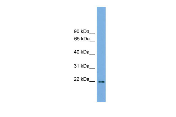 1 - Jundm2 antibody - C-terminal region AI11211