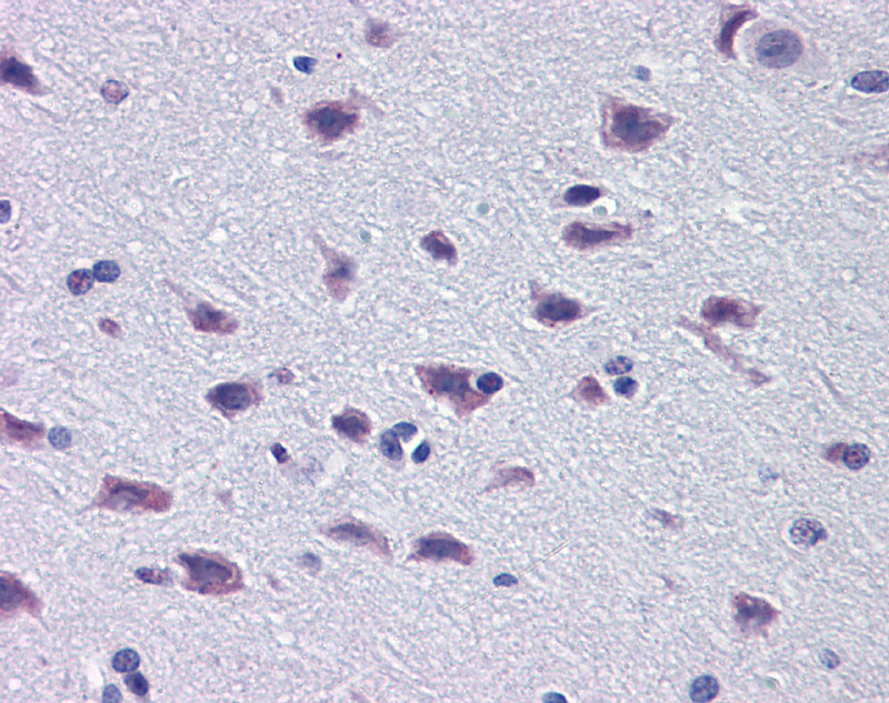2 - DMBX1 antibody - middle region AI11222