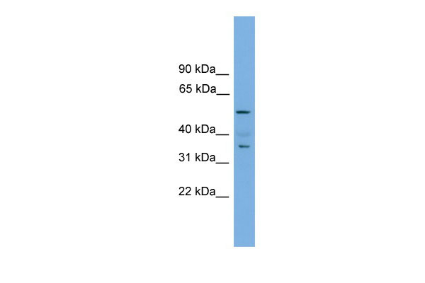 1 - Nobox antibody - middle region AI11224