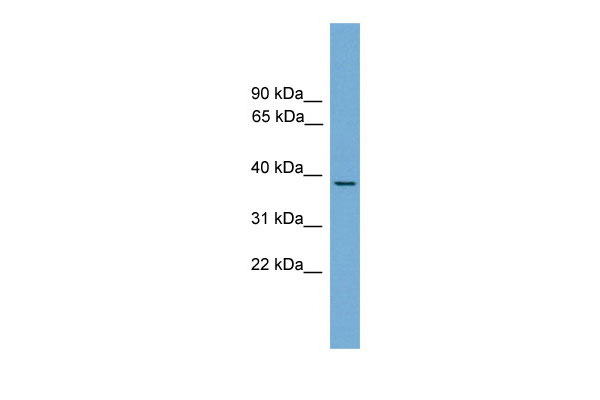 1 - B230358A15Rik antibody - middle region AI11246